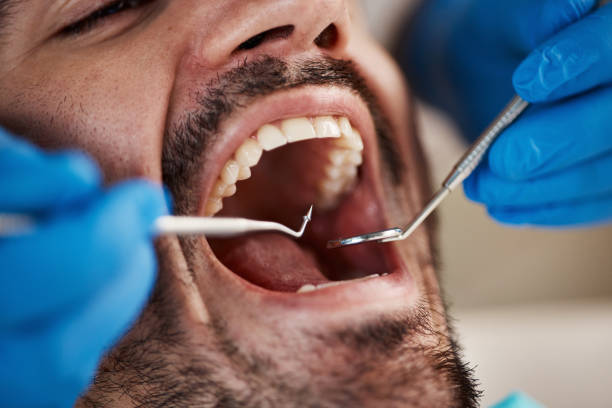 Best Dentist for Tooth Abscess  in Richland, PA